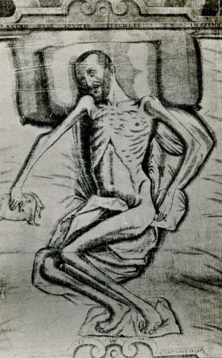back and white drawing of a skinny man on a bed